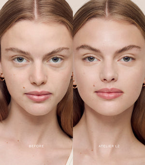 Before and after comparison of a woman's face with Atelier L2 treatment.