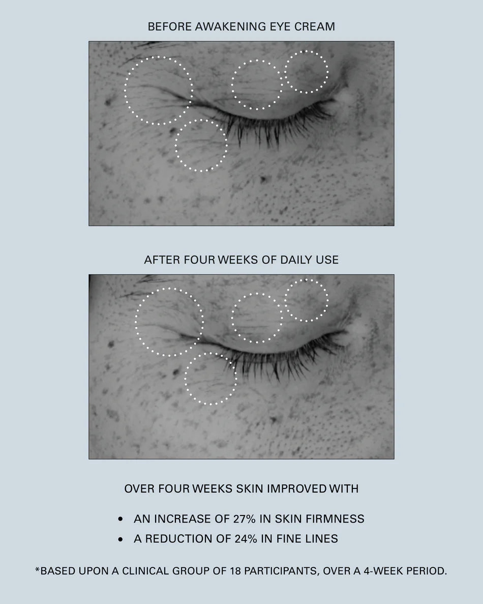 A before and after of a person who has used the Awakening Eye Cream for four weeks