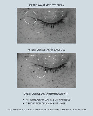 A before and after of a person who has used the Awakening Eye Cream for four weeks